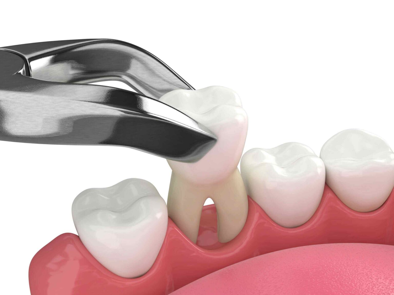 How Soon Can I Eat After Tooth Extraction? | Lumos Dental