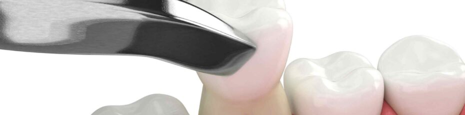 how soon can i eat after tooth extraction