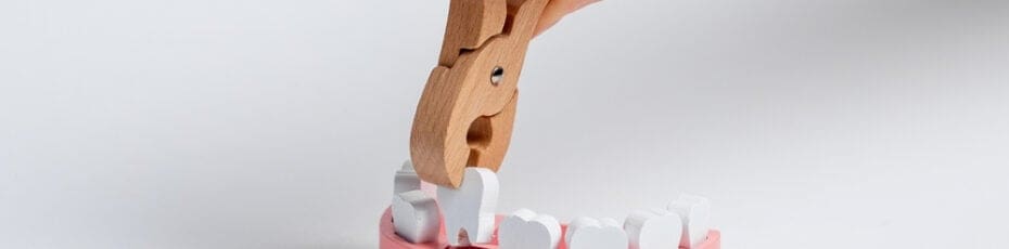 facts you must know about wisdom tooth removal